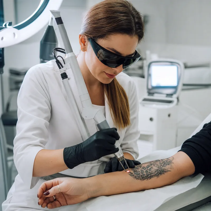Blink Tattoo Removal